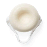 An image of the birth control sponge